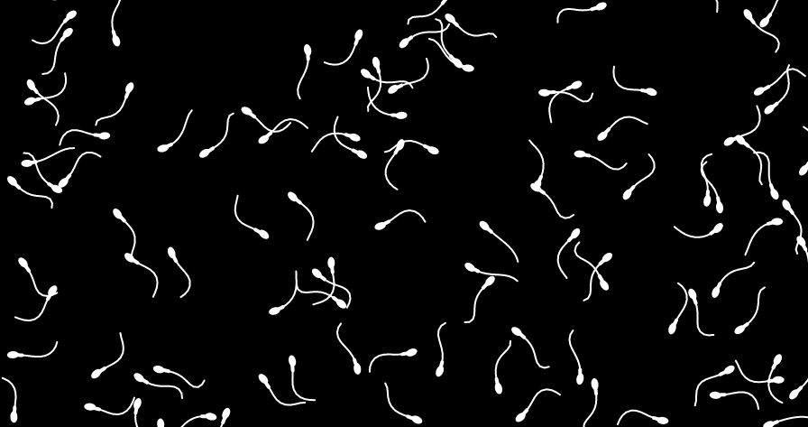 Flocking with Sperm